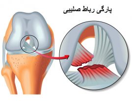 رباط صلیبی