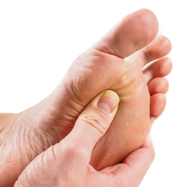 مهمترین علل احساس درد در زیر انگشتان پا