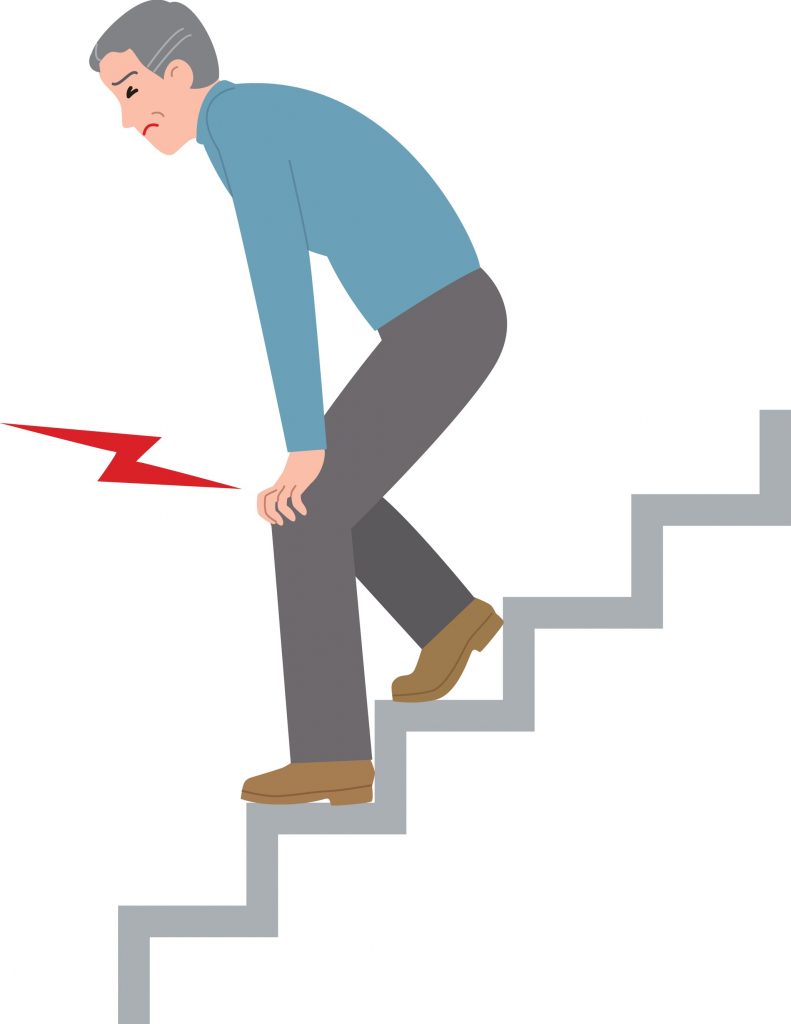 دلایل زانو درد به هنگام پایین رفتن از پله 