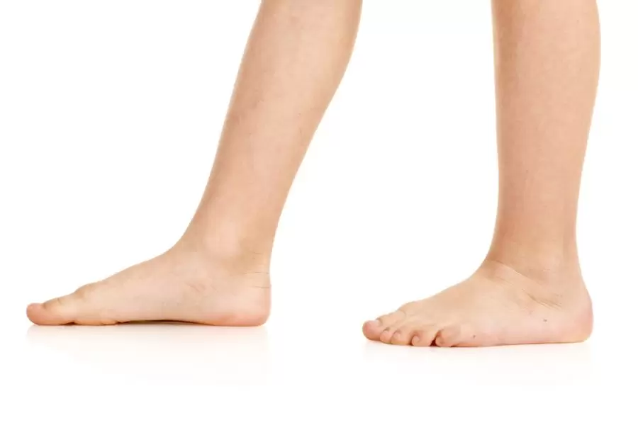 صافی کف پا چیست