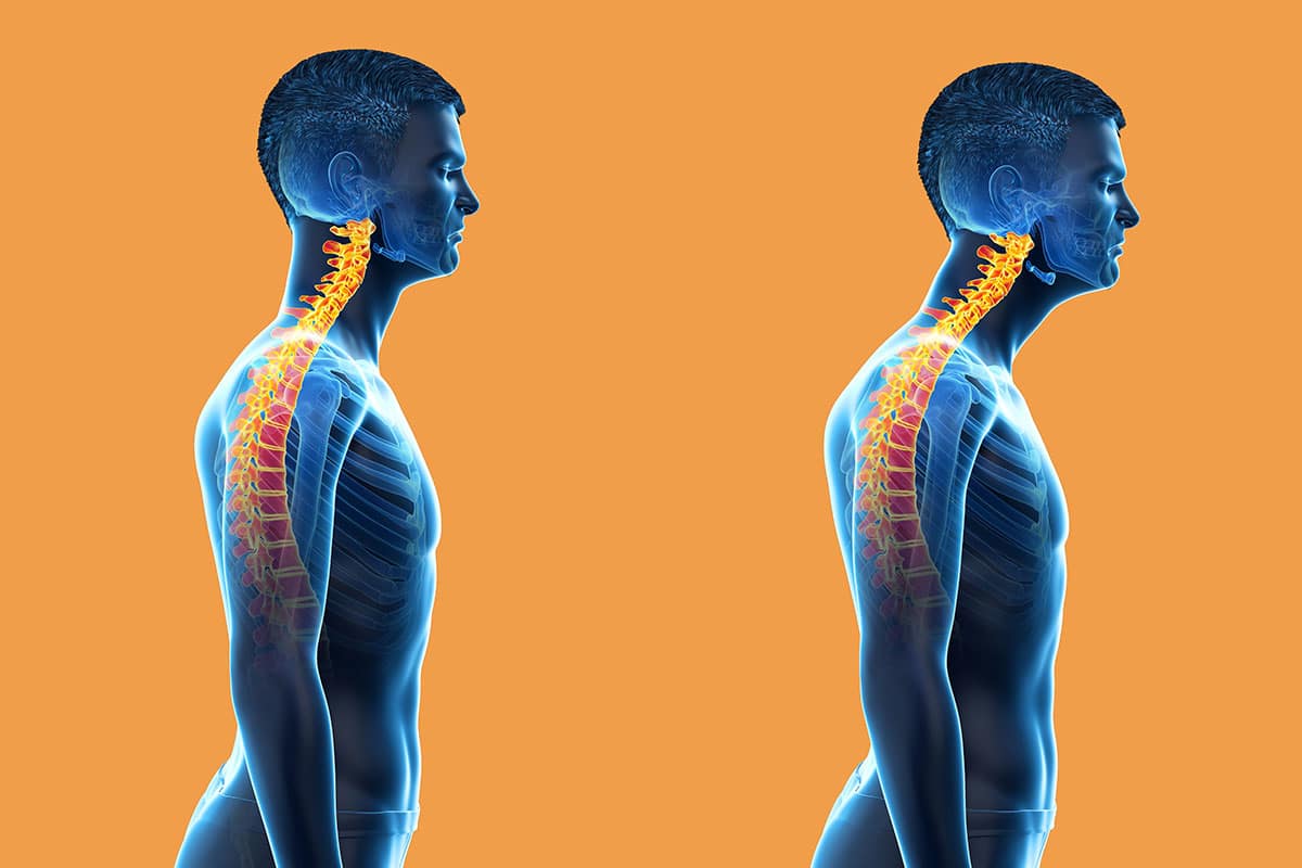 Corrective movements of the neck forward