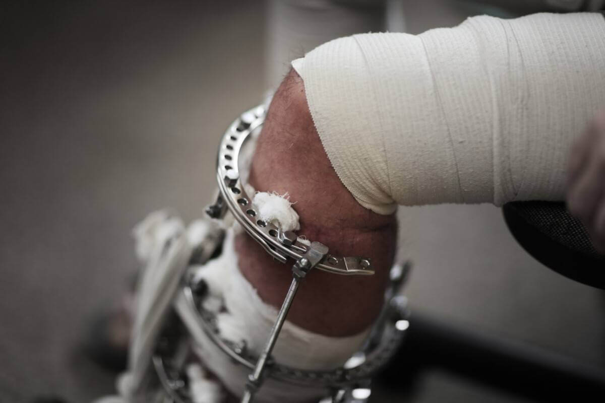 عمل الیزاروف