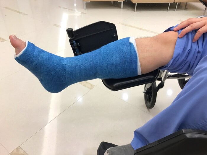 عمل پلاتین پا