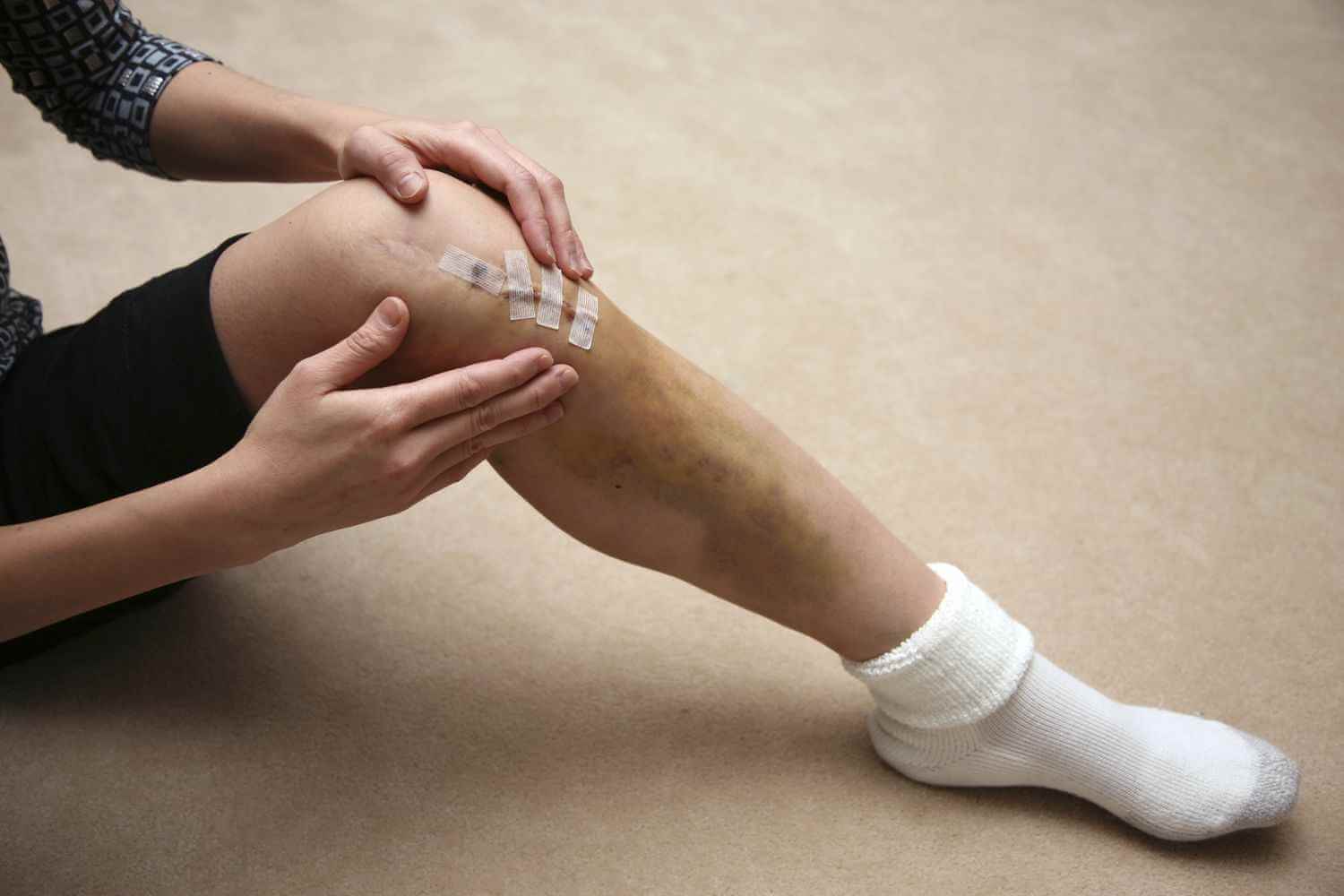 12مراقبت بعد از عمل رباط صلیبی