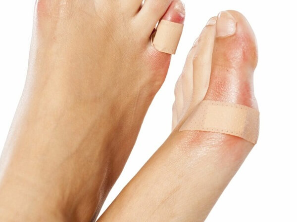 علائم ضرب دیدگی انگشت پا