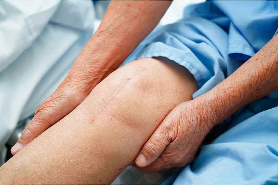درمان خشک شدن زانو بعد از عمل