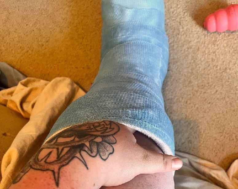 چرا گچ پام شل شده