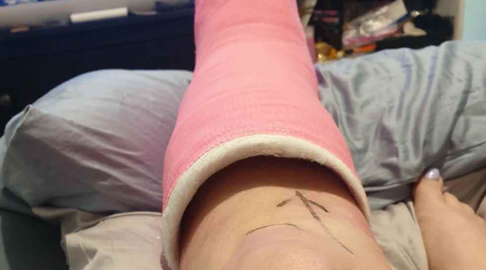 علت گشاد شدن گچ پا