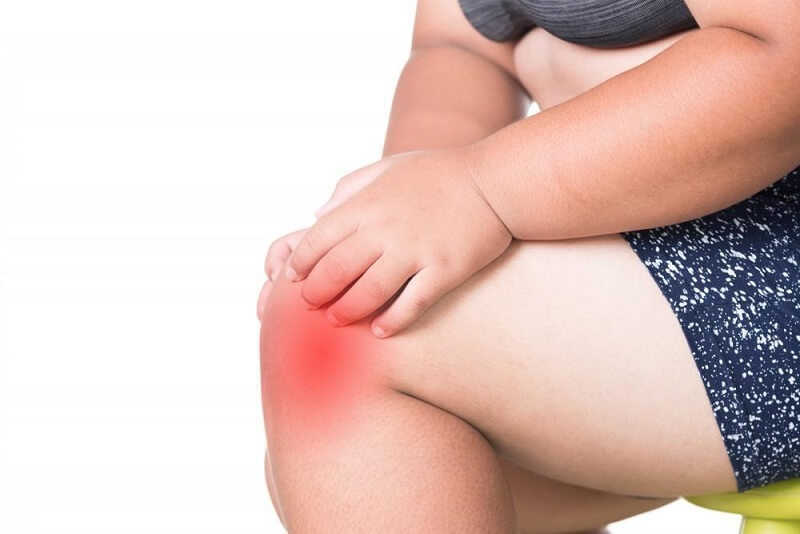 تاثیر چاقی بر آرتروز زانو