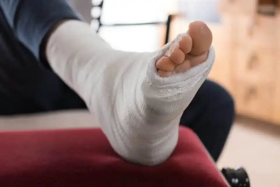 شکستگی استخوان روی پا