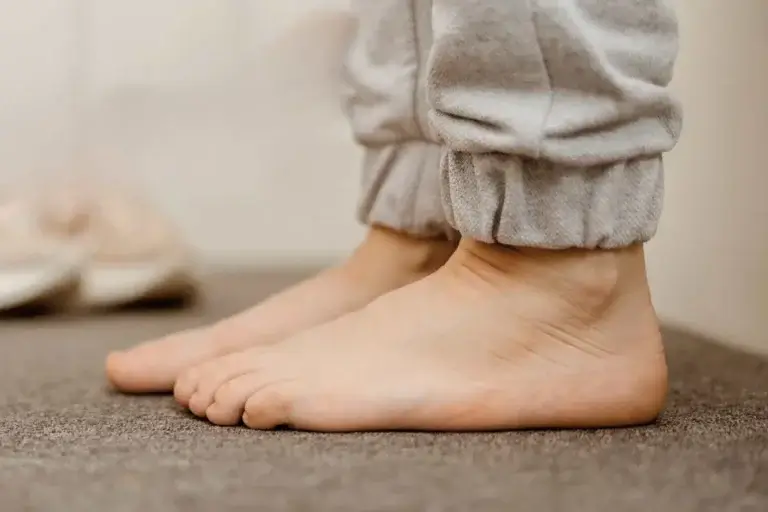 کف پای صاف در نوجوانان